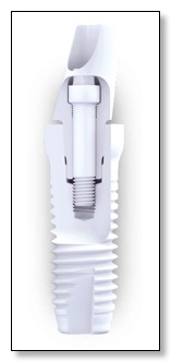 Z-Systems cereamic implant cross section